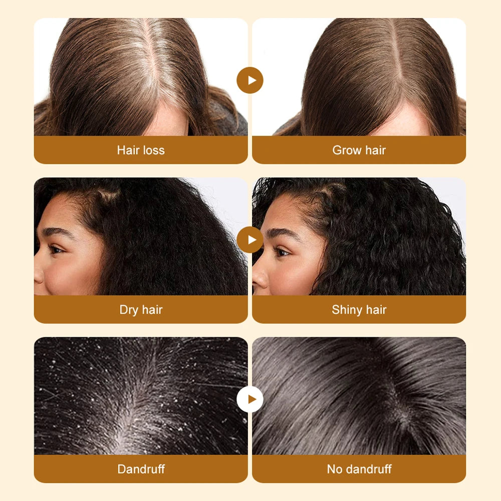 Merzuvo™ Batana Natural Hair Growth Cream