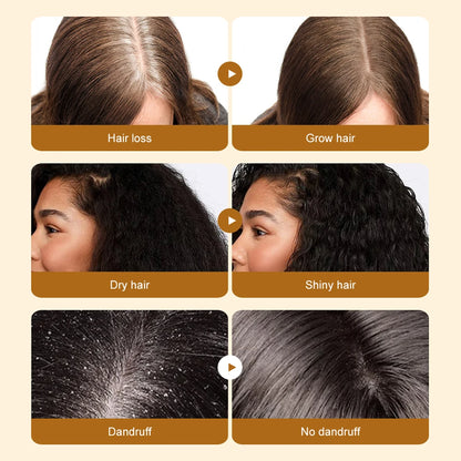 Merzuvo™ Batana Natural Hair Growth Cream