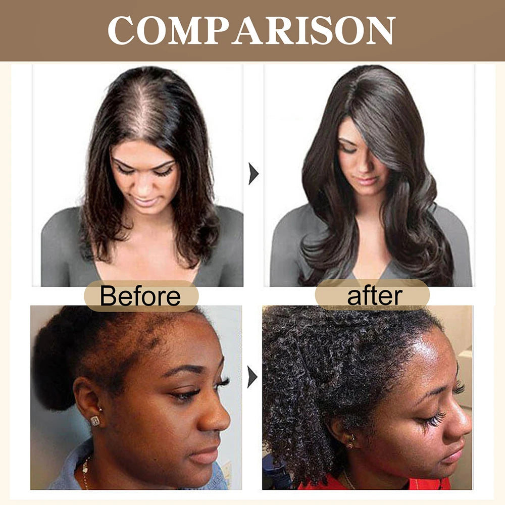 Merzuvo™ Batana Natural Hair Growth Cream