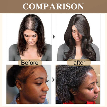Merzuvo™ Batana Natural Hair Growth Cream